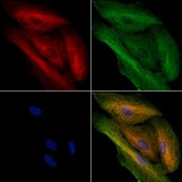 Anti-MFN1 antibody used in Immunocytochemistry/ Immunofluorescence (ICC/IF). GTX05150