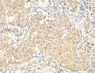 Anti-MFN2 antibody used in IHC (Paraffin sections) (IHC-P). GTX05151