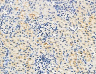 Anti-MFN2 antibody used in IHC (Paraffin sections) (IHC-P). GTX05151