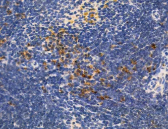 Anti-MFN2 antibody used in IHC (Paraffin sections) (IHC-P). GTX05151