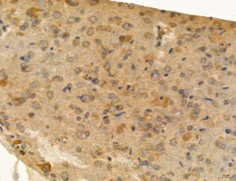 Anti-MFN2 antibody used in IHC (Paraffin sections) (IHC-P). GTX05151
