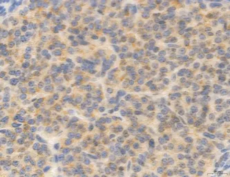 Anti-MFN2 antibody used in IHC (Paraffin sections) (IHC-P). GTX05151