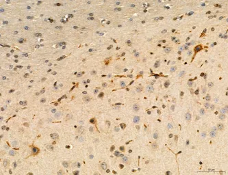 Anti-MFN2 antibody used in IHC (Paraffin sections) (IHC-P). GTX05151