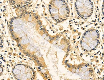 Anti-MFN2 antibody used in IHC (Paraffin sections) (IHC-P). GTX05151