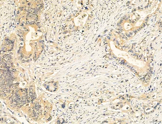 Anti-MFN2 antibody used in IHC (Paraffin sections) (IHC-P). GTX05151