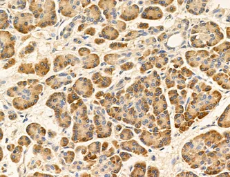 Anti-MFN2 antibody used in IHC (Paraffin sections) (IHC-P). GTX05151