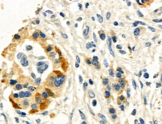 Anti-MFN2 antibody used in IHC (Paraffin sections) (IHC-P). GTX05151