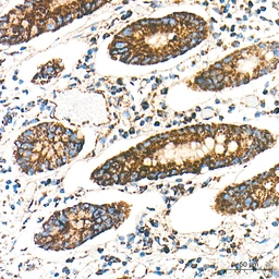 Anti-SHMT2 antibody [ARC78312] used in IHC (Paraffin sections) (IHC-P). GTX05153