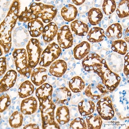 Anti-SHMT2 antibody [ARC78312] used in IHC (Paraffin sections) (IHC-P). GTX05153
