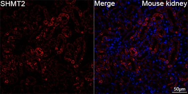 Anti-SHMT2 antibody [ARC78312] used in IHC (Paraffin sections) (IHC-P). GTX05153