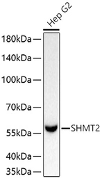 Anti-SHMT2 antibody [ARC78312] used in Western Blot (WB). GTX05153