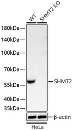 Anti-SHMT2 antibody [ARC78312] used in Western Blot (WB). GTX05153