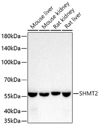 Anti-SHMT2 antibody [ARC78312] used in Western Blot (WB). GTX05153