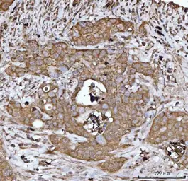 Anti-HBEGF antibody used in IHC (Paraffin sections) (IHC-P). GTX05154