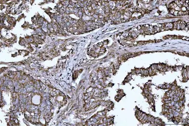 Anti-HBEGF antibody used in IHC (Paraffin sections) (IHC-P). GTX05154
