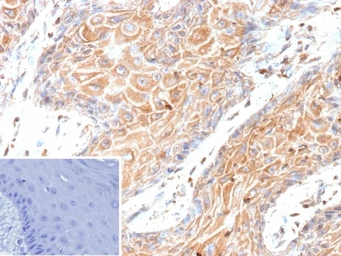 Anti-HBEGF antibody [HBEGF/9503] used in IHC (Paraffin sections) (IHC-P). GTX05155