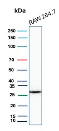 Anti-HBEGF antibody [HBEGF/9503] used in Western Blot (WB). GTX05155