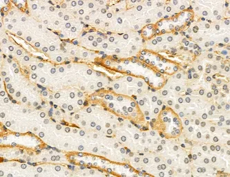 Anti-NEU4 antibody used in IHC (Paraffin sections) (IHC-P). GTX05156