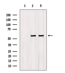 Anti-NEU4 antibody used in Western Blot (WB). GTX05156