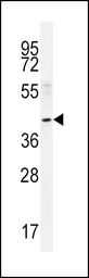 Anti-NEU2 antibody used in Western Blot (WB). GTX05157