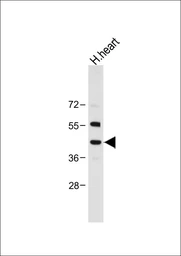Anti-NEU2 antibody used in Western Blot (WB). GTX05157