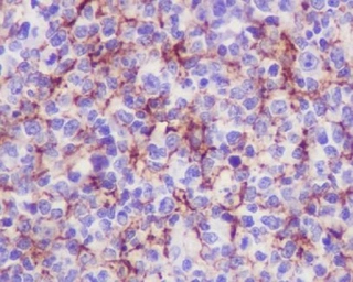 Anti-VCAM1 / CD106 antibody [DCA-22] used in IHC (Paraffin sections) (IHC-P). GTX05158