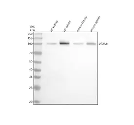 Anti-VCAM1 / CD106 antibody [DCA-22] used in Western Blot (WB). GTX05158