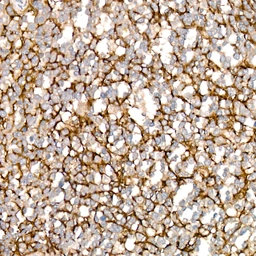 Anti-VCAM1 / CD106 antibody [ARC61231] used in IHC (Paraffin sections) (IHC-P). GTX05160