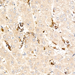 Anti-VCAM1 / CD106 antibody [ARC61231] used in IHC (Paraffin sections) (IHC-P). GTX05160
