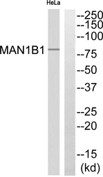 Anti-MAN1B1 antibody used in Western Blot (WB). GTX05162