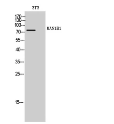 Anti-MAN1B1 antibody used in Western Blot (WB). GTX05162