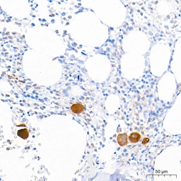Anti-TGF beta 1 antibody [ARC3248] used in IHC (Paraffin sections) (IHC-P). GTX05163