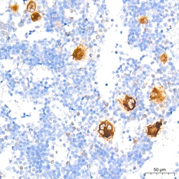 Anti-TGF beta 1 antibody [ARC3248] used in IHC (Paraffin sections) (IHC-P). GTX05163