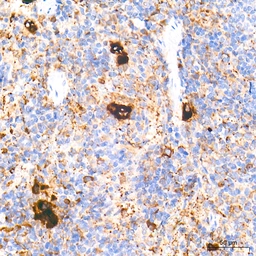 Anti-TGF beta 1 antibody [ARC3248] used in IHC (Paraffin sections) (IHC-P). GTX05163