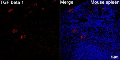 Anti-TGF beta 1 antibody [ARC3248] used in IHC (Paraffin sections) (IHC-P). GTX05163