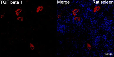 Anti-TGF beta 1 antibody [ARC3248] used in IHC (Paraffin sections) (IHC-P). GTX05163