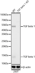 Anti-TGF beta 1 antibody [ARC3248] used in Western Blot (WB). GTX05163