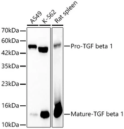 Anti-TGF beta 1 antibody [ARC3248] used in Western Blot (WB). GTX05163