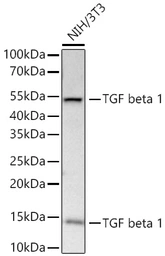 Anti-TGF beta 1 antibody [ARC3248] used in Western Blot (WB). GTX05163