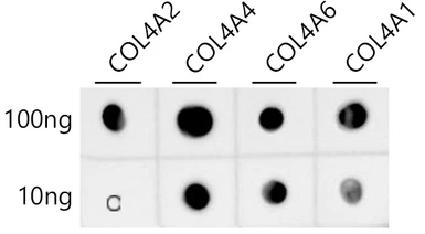 Anti-Collagen IV antibody [ARC62585] used in Dot blot (Dot). GTX05165