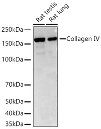 Anti-Collagen IV antibody [ARC62585] used in Western Blot (WB). GTX05165