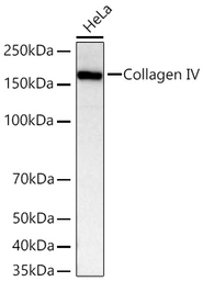 Anti-Collagen IV antibody [ARC62585] used in Western Blot (WB). GTX05165
