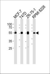 Anti-ZDHHC11 antibody used in Western Blot (WB). GTX05166