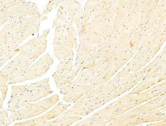 Anti-p70 S6K (phospho Thr389/Thr412) antibody used in IHC (Paraffin sections) (IHC-P). GTX05173