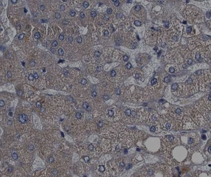 Anti-p70 S6K (phospho Thr389/Thr412) antibody used in IHC (Paraffin sections) (IHC-P). GTX05173