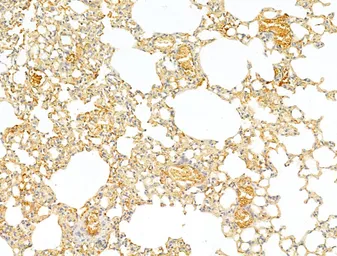 Anti-p70 S6K (phospho Thr389/Thr412) antibody used in IHC (Paraffin sections) (IHC-P). GTX05173
