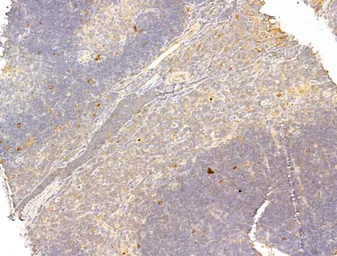 Anti-p70 S6K (phospho Thr389/Thr412) antibody used in IHC (Paraffin sections) (IHC-P). GTX05173