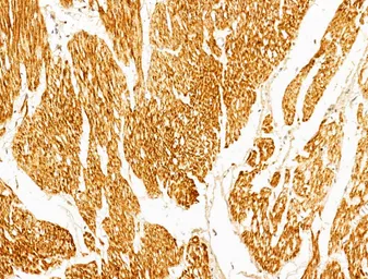 Anti-p70 S6K (phospho Thr389/Thr412) antibody used in IHC (Paraffin sections) (IHC-P). GTX05173