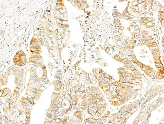 Anti-p70 S6K (phospho Thr389/Thr412) antibody used in IHC (Paraffin sections) (IHC-P). GTX05173