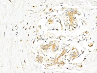 Anti-p70 S6K (phospho Thr389/Thr412) antibody used in IHC (Paraffin sections) (IHC-P). GTX05173